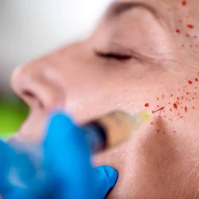جوانسازی و شادابی پوست با پکیج تخصصی